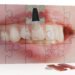 shutterstock 58440439 scaled
